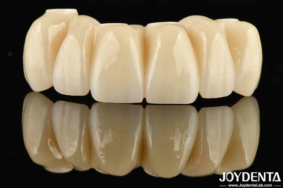 Restauración dental Ti-Base Zirconia Puente híbrido de aspecto natural ajuste preciso