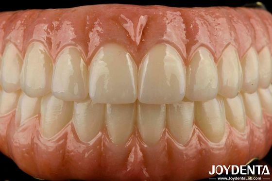 Precisión de ajuste dental Ti-Bar Zirconia Hybrid Puente de reemplazo para los dientes faltantes
