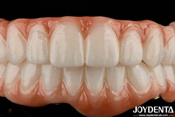 Barras de titanio de larga duración puente híbrido de zirconia aspecto natural estética para la restauración