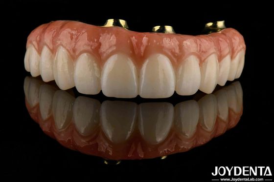 Comodidad de uso Barras de titanio Zirconia Puente híbrido Alta biocompatibilidad Duradera