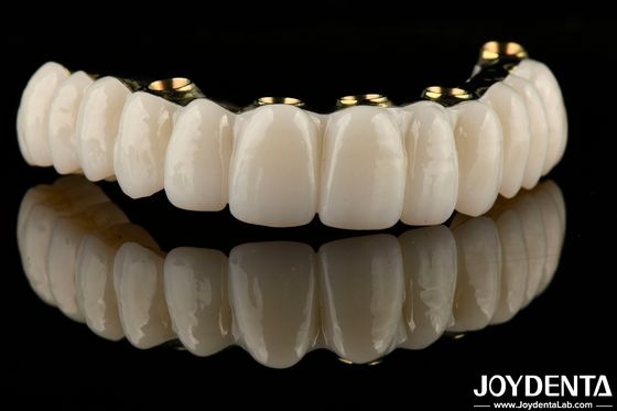 Puente de implante de zirconia híbrido suave Restaurar la función de masticación