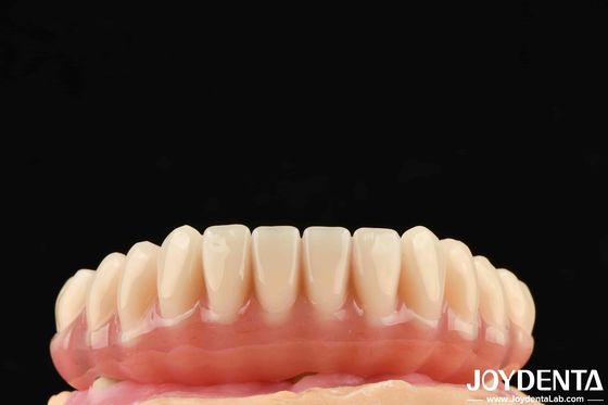 1 pieza Ti-base Dientes de acrílico acabado de color translúcido Dental resinas de acrílico