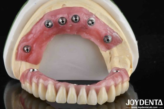 Finish de dientes acrílicos translúcidos de base de Ti para la producción de laboratorios dentales