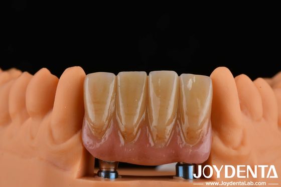 4.5 mm de altura Abutments acabados Tipo de conexión hexagonal interna Compatible con sistemas de implantes