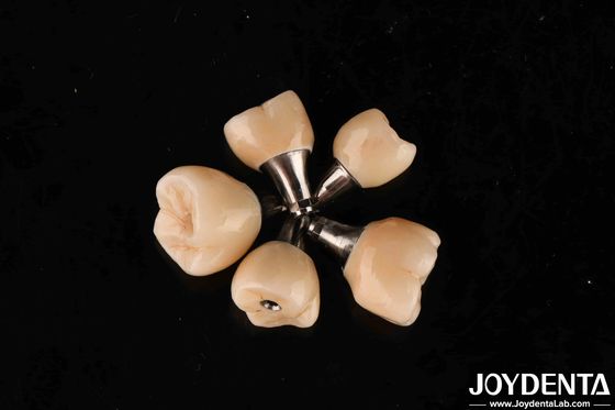 Conexión hexagonal interna para implantes dentales