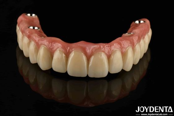 Puente híbrido dental de titanio personalizado Resistencia a la corrosión ajustable