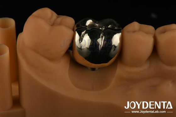 Rehabilitación oral Cera de fundición FMC Corona de metal completo para la reparación clínica dental