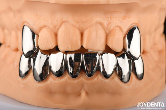 Corona dental resistente a abrasivos de metal completo, FMC metálico para la rehabilitación oral