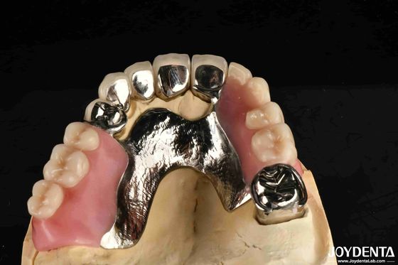 Elaborar el marco final conjunto estructura dental estable diseño de los dientes acabado