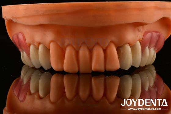 Cuadro Configuración Dientes acabado Tecnología elaborada Hermoso diseño de apariencia armoniosa