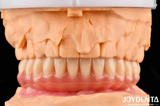 Dentadura natural de aspecto acrílico con alta biocompatibilidad con tecnología de arreglo dental