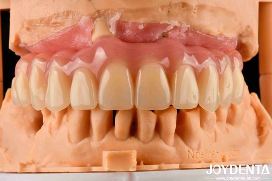 Dentadura de acrílico con tecnología de arreglo dental