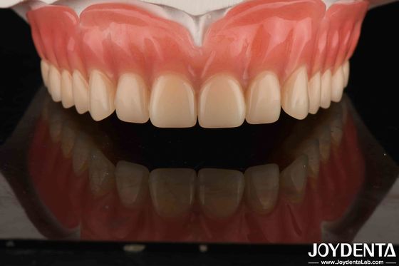 Dientes de acrílico Material de resina ligero Restauración dental Disposiciones dentales