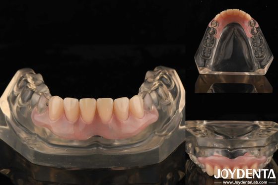 Tecnología de arreglo de dientes Dentadura flexible Finish de alta elasticidad Personalización