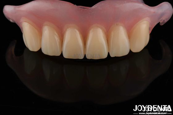 Dentadura removible flexible y de alta sigilo con acabado confortable y adecuado