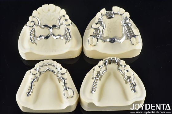 Marco dental de diseño extraíble para encajar en la boca que apoya la masticación