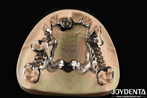 Material biocompatible dental de estructura metálica de soporte personalizado
