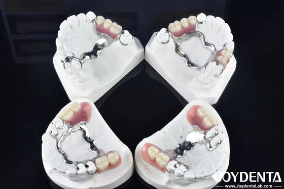 Establecer un marco tecnológico para el acabado de los dientes para una estructura oral estable