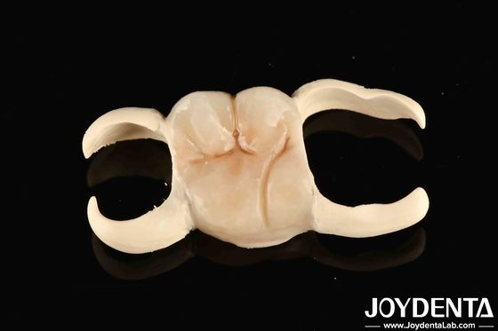 M75 Dureza Discos dentales de material PMMA Resistente a los arañazos para sistemas CAD / CAM