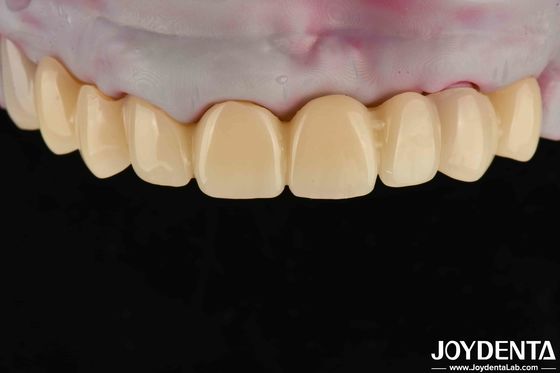 Material dental PMMA de alta transparencia Color natural Estética realista