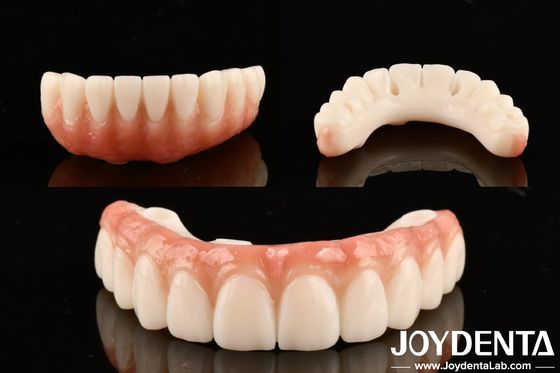 Dental de alta transparencia PMMA M75 para restauraciones estéticas y resistentes a los arañazos