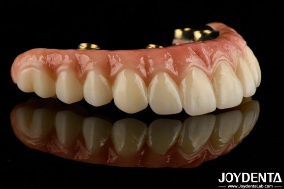 Puente híbrido de zirconia de barra de Ti para prótesis dentales duraderas
