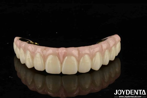 Alta durabilidad Zirconia Solución definitiva para la compatibilidad de los dientes y las encías naturales