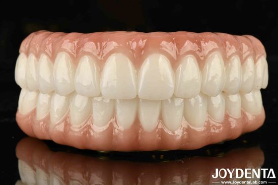 Puente híbrido de zirconia de alta biocompatibilidad para ajuste preciso y reemplazo de dientes faltantes