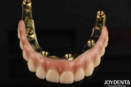 Protesis dental Puente híbrido de zircónia con altos estándares de biocompatibilidad
