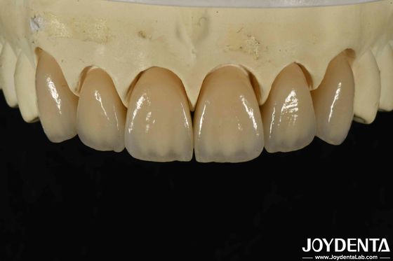 Excelente biocompatibilidad Zirconia en capas con alta estética y densidad 6.0-6.1 G/cm3
