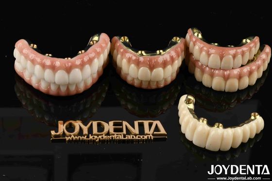 Zirconia para restablecer la función de masticación Funcionalidad óptima garantizada