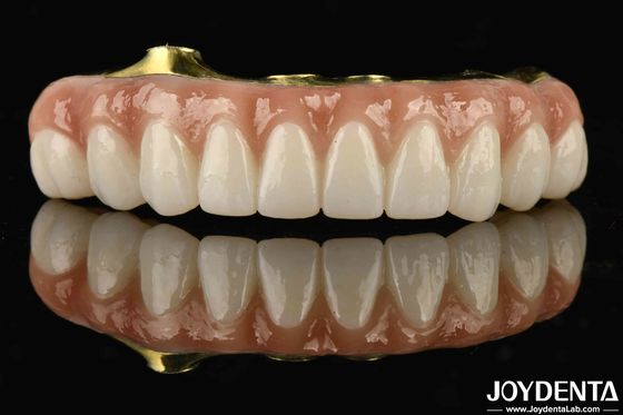 Titanio y zirconio confort confortable para usar Ti-Bar zirconio puente híbrido para reemplazar los dientes perdidos