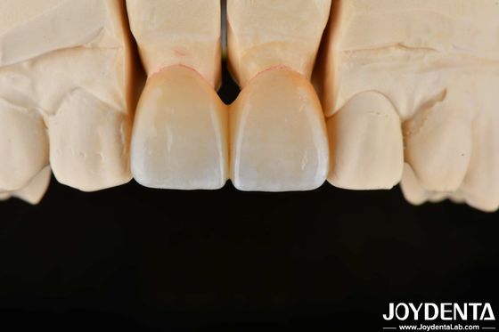 1350-1450°C Temperatura de sinterización Zirconia en capas para una biocompatibilidad superior y conductividad térmica