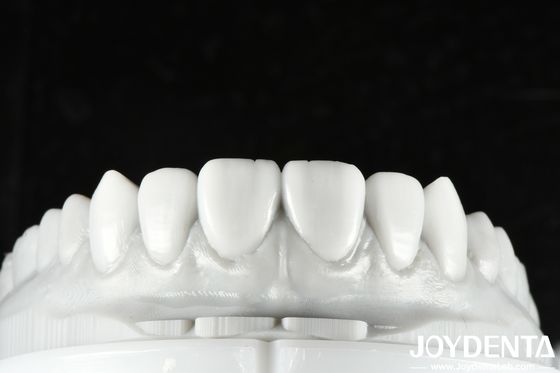 Cera dental de color natural Solución versátil para la restauración de dientes simples o múltiples