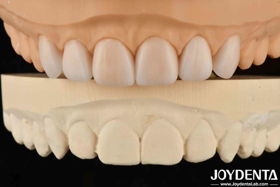 Propiedad ligera Dentadura Flexible Finish Personalización personalizada para diversas especificaciones