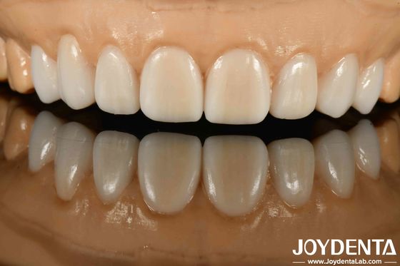 Alto sigilo Materiales diversos de metales y resinas Flexible Dentadura para tecnología avanzada de sigilo
