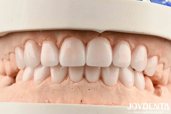 Materiales diversos y buena elasticidad en el acabado de prótesis flexibles para metales y resinas