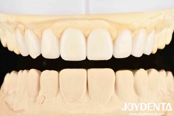 La buena elasticidad dental y la tecnología de arreglo dental