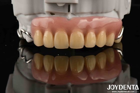 Elaborar el marco de la estructura oral estable y estable para establecer el acabado dental para una salud oral óptima