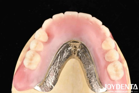 Firmemente conectar la fila de dientes elaborar el marco de la tecnología establecer los dientes de acabado para los profesionales dentales y resultados precisos