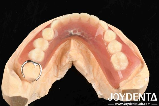 Metales y resinas marco de la configuración dental de los dientes para la estructura oral estable