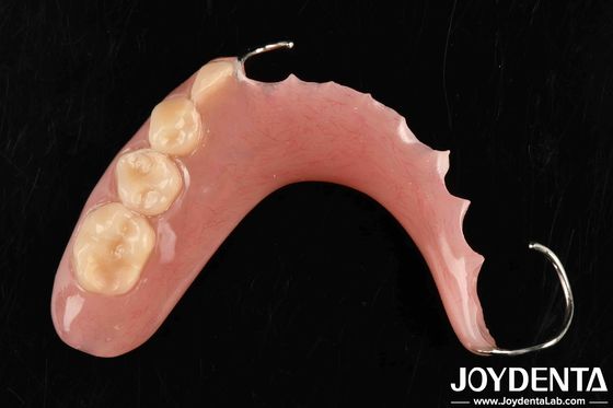 Desarrollar tecnología para el marco de estructura oral estable Establecer los dientes en la aplicación dental