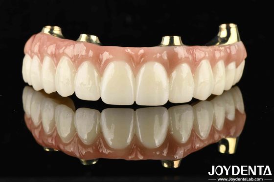 Funcionalidad Ti-Bar compatible con los dientes y las encías naturales restaura la función de masticación