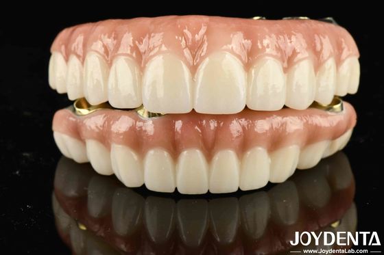Puente híbrido de zirconia de Ti-Bar de alta durabilidad para lograr estética