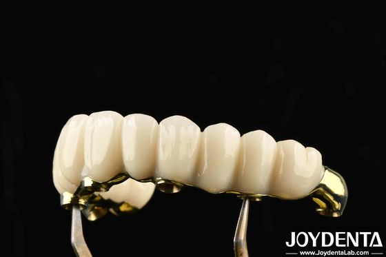 Confortable para usar Ti-Bar Zirconia Hybrid Bridge Restaura la función de masticación Compatible con dientes y encías naturales