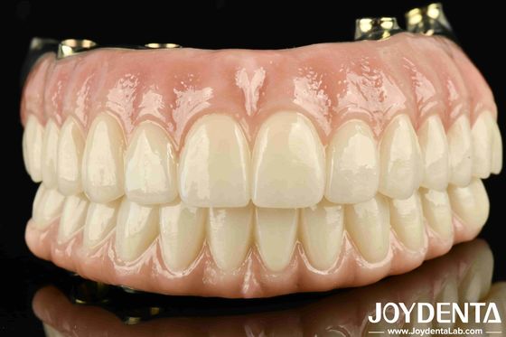 Puente híbrido de zirconia de alta durabilidad hecha a medida para satisfacción personalizada garantizada