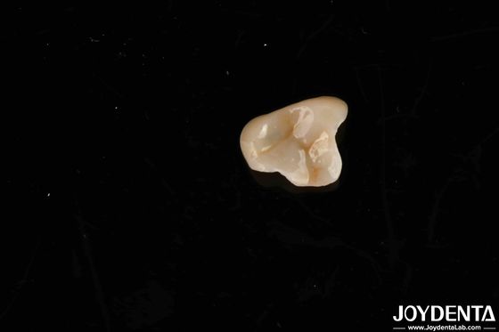 Material no tóxico E-max Solución final Emax Inlay Onlay para normas de biocompatibilidad