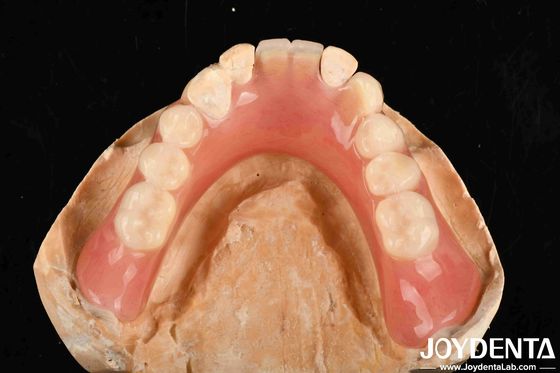 Peso ligero buena biocompatibilidad dentadura acrílica finaliza personalización personalizada en equipos médicos