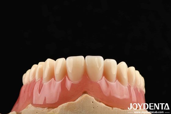 Fin de dentadura acrílica de buena elasticidad para personalización personalizada y diseño personalizado de peso ligero