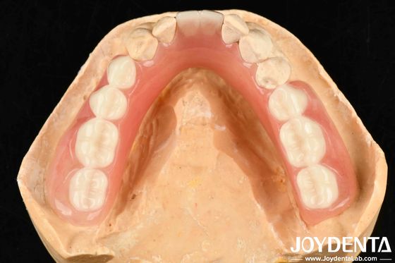 Material de resina diverso y ligero acabado de dentadura acrílica